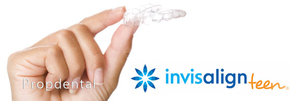 S In Mind Invisalign Teen 64