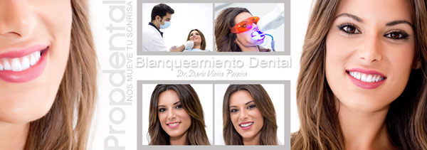 blanquear los dientes en el dentista