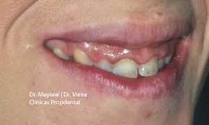 perfil paciente estetica dental