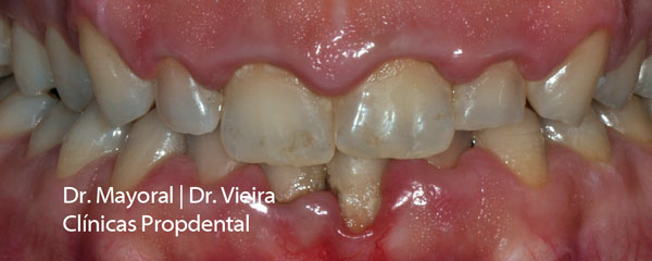 dientes