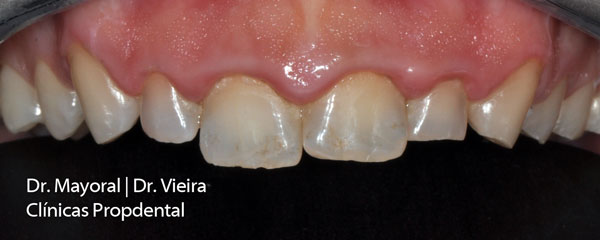 estetica dental