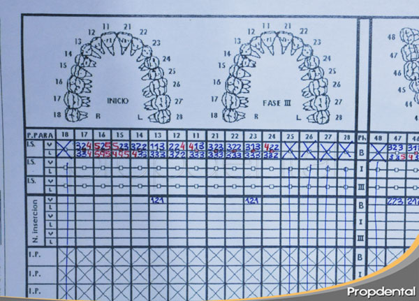 periodontograma y sondaje periodontal