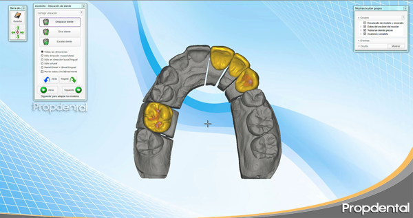 tecnología cad cam dental