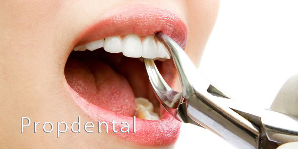 extracciones dentales en Barcelona, Badalona y Madrid en Propdental