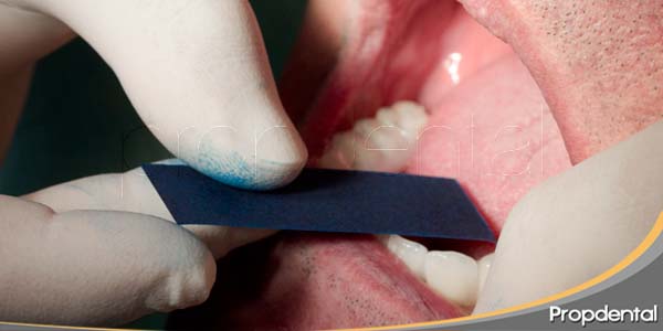 oclusión e implantes