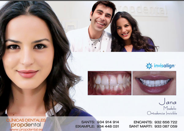 ortodoncia invisalign qué es y su funcionamiento