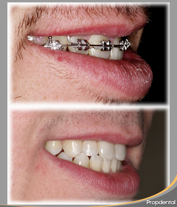 perfil del paciente propdental