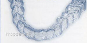 precio invisalign precio ortodoncia invisible