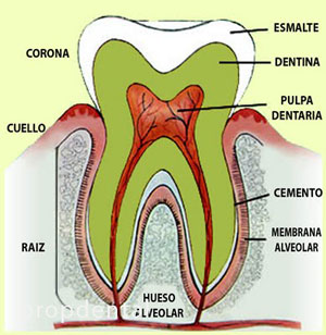 pulpa dental o nervio del diente