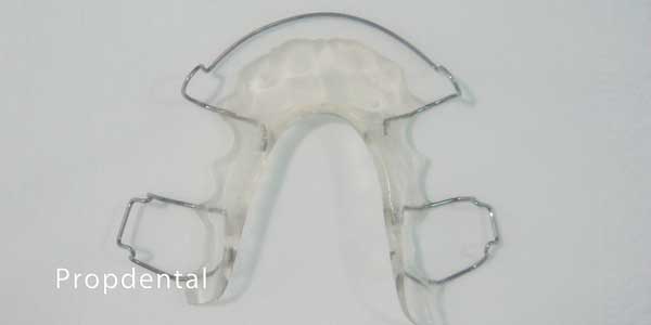retenedor removible de ortodoncia