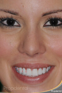forma de los dientes
