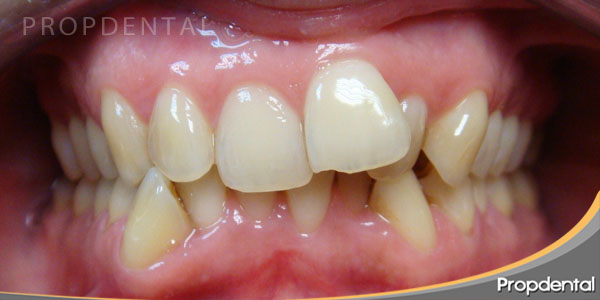 caso clinico de ortodoncia