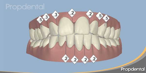 antes de iniciar el tratamiento de ortodoncia invisible, la visión en 3D de la boca del paciente de Propdental