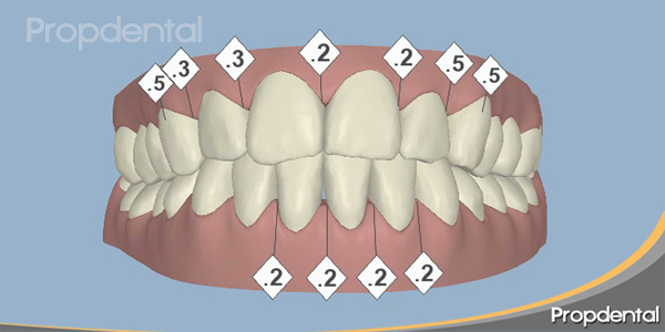 clinchek después del tratamiento dental