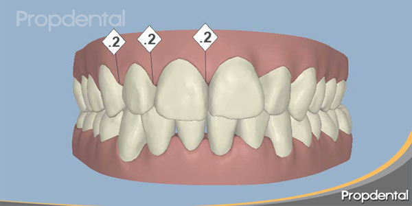 clincheck incial