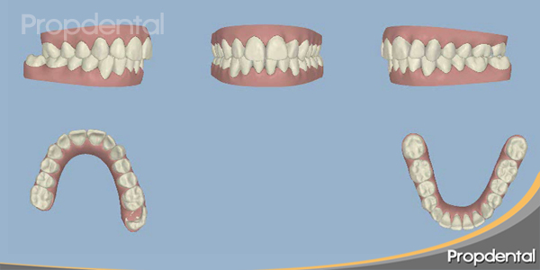 dientes en 3d posición inicial