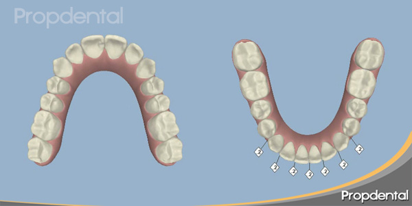 ortodoncia guiada por ordenador