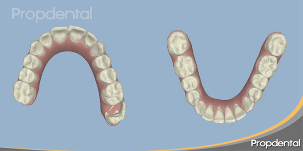 posición final de los dientes en 3d