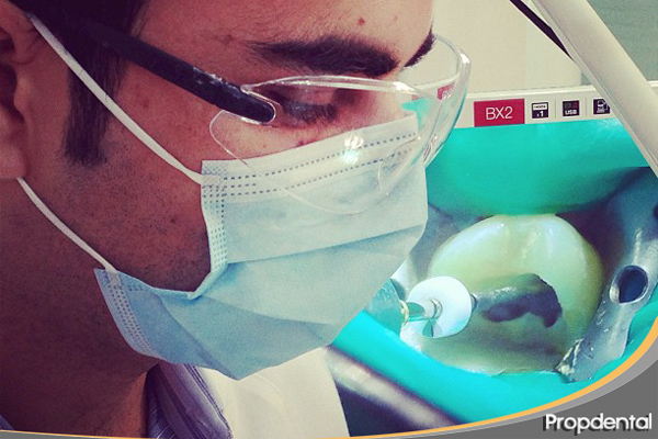 alternativa a la endodoncia
