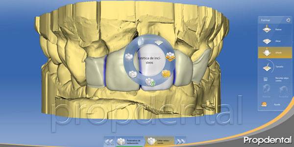 cad cam dental