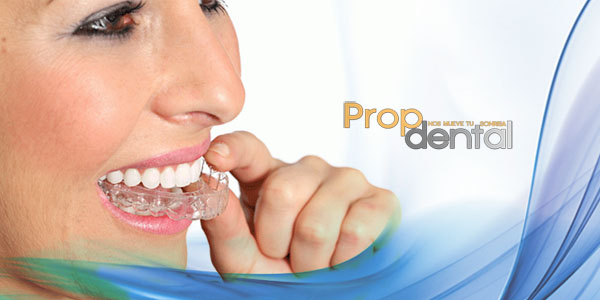 cuanto dura el tratamiento invisalign