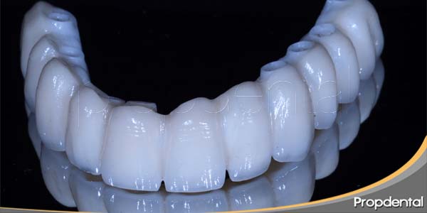 prótesis de circonio sobre implantes dentales