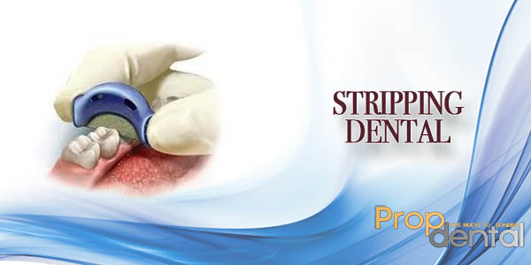 Reducción interproximal de los dientes para ortodoncia
