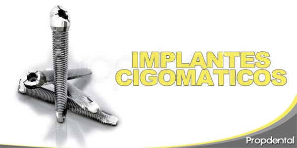 implantes cigomáticos