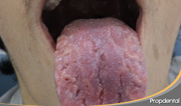 lengua geografica
