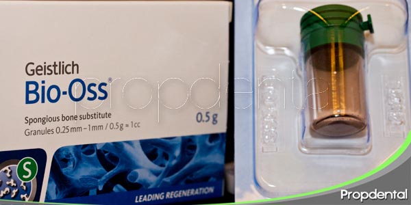 injerto de hueso y tejido para tratar una gingivitis crónica