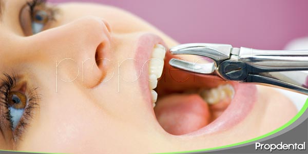 diferentes tipos de extracciones dentales