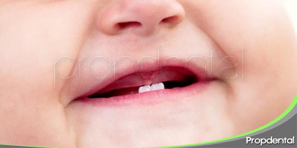 retraso en la erupción de los dientes de leche
