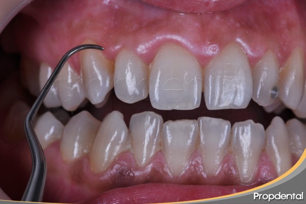 todo cirugia periodontal