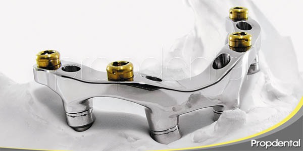 ¿Problemas con los implantes dentales?