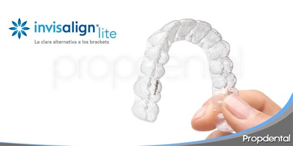 ventajas e inconvenientes de invisalign lite