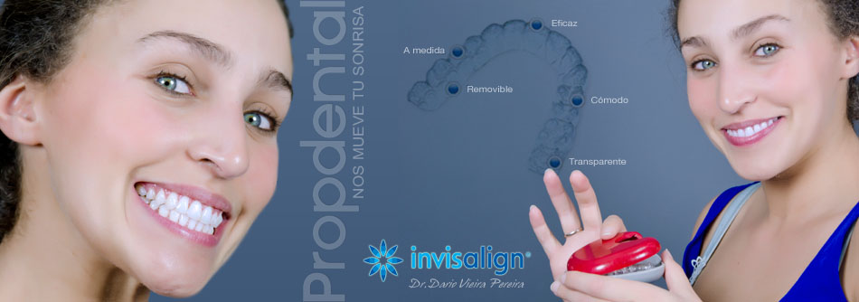 invisalign propdental