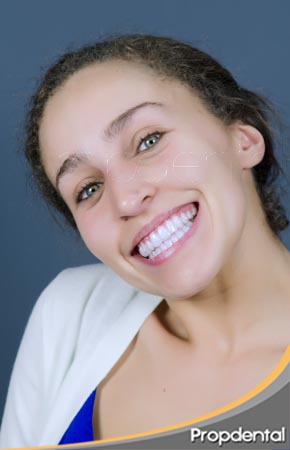 ortodoncia invisalign