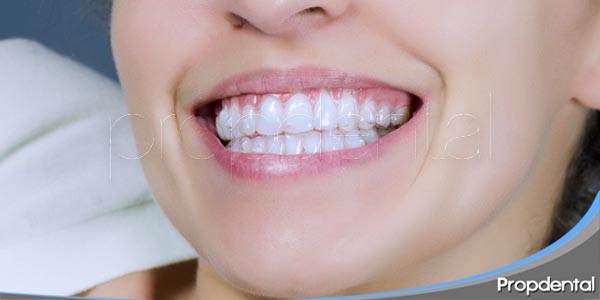 ¿En que consiste la técnica Invisalign Clínicas Propdental