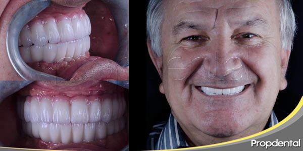 Salud Bucodental en Pacientes Geriátricos