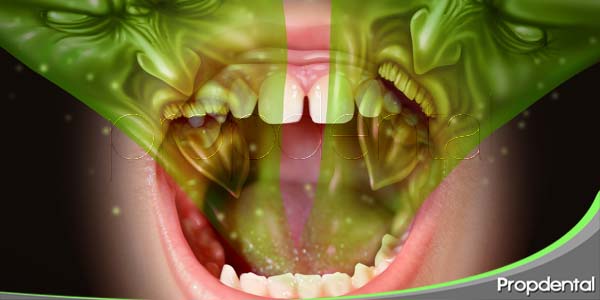 halitosis o mal olor de boca