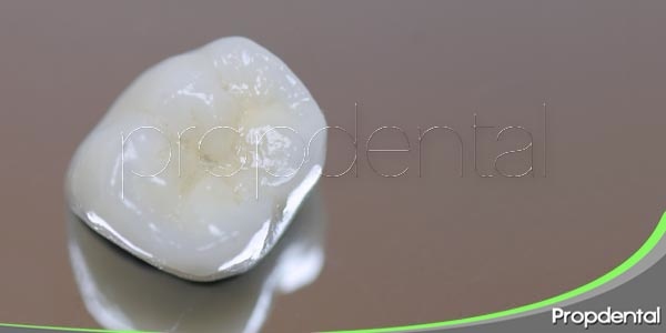 corona dental de porcelana