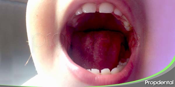 ¿Significa algo la separación entre los dientes de leche?