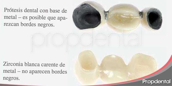 diferencia entre corona metal ceramica y corona de zirconio