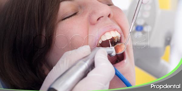 Duración de un empaste dental