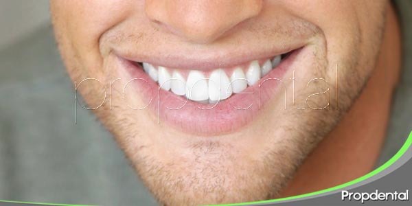 ¿A quién no le gustaría lucir una sonrisa radiante?