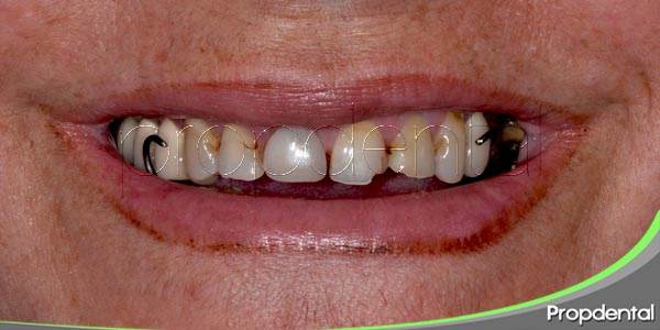 Nuestra dentición envejece junto con nosotros