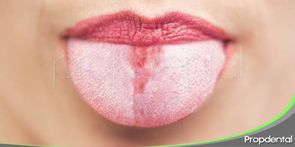 ¿Qué es la candidiasis oral?