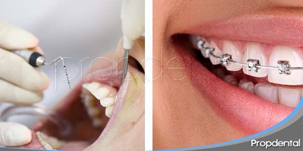Relación entre periodoncia y ortodoncia