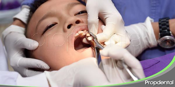 ¿En qué casos se indica una exodoncia?