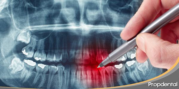 radiografía-dental-es-peligrosa-en-embarazadas